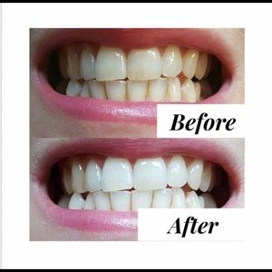 Whitening Toothpaste